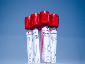 威高血净:山东威高血液净化制品股份有限公司关于使用募集资金置换预先投入募集资金投资项目及已支付发行费用的自筹资金的公告